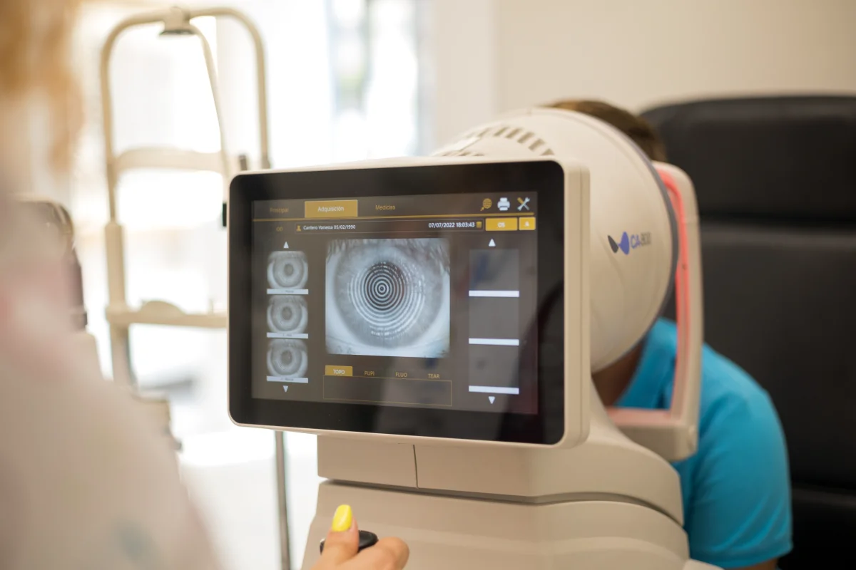 Topografía Corneal - Ortoqueratología en Jaén